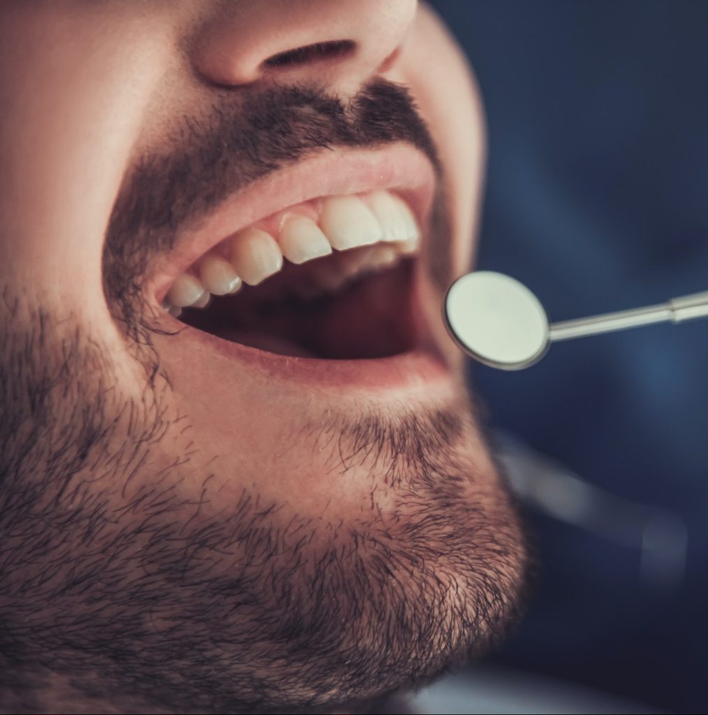 At the dentist Full Mouth Reconstruction