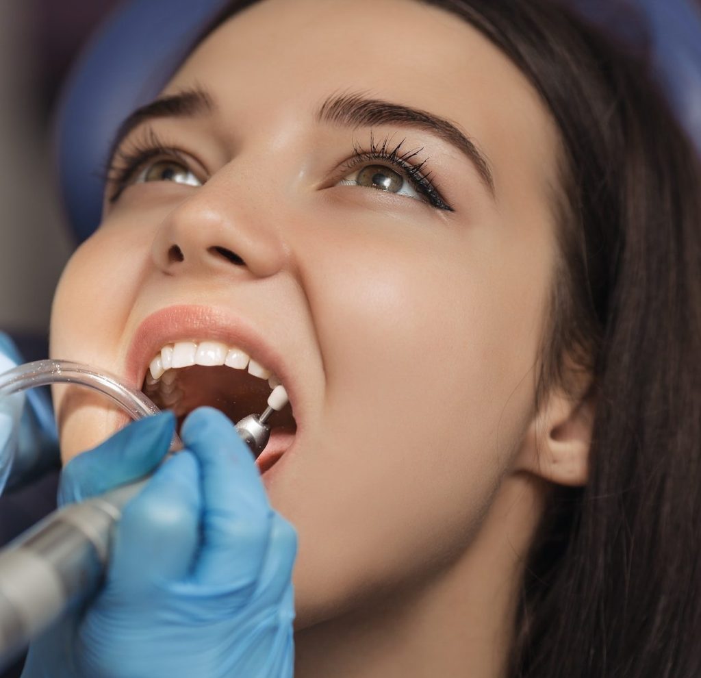 Dentist polishing patient teeth at the dental office.