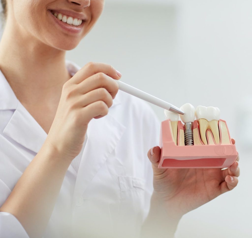Smiling Dentist Explaining Tooth Implantation