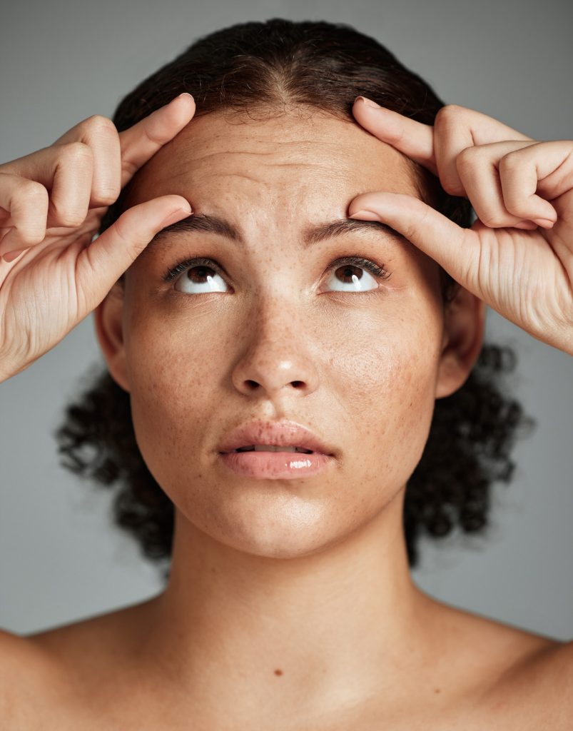 Wrinkles, skincare and beauty worry of a black woman with wellness facial, botox help and face prp. Botox and Fillers