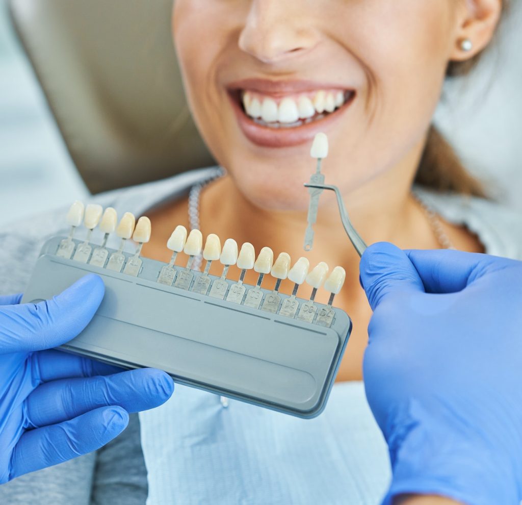 Patient Services Male dentist and woman choosing tooth shade in dentist office